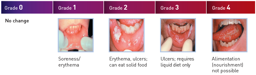 about mucositis